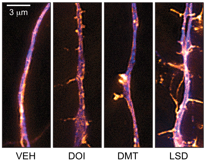 Psychedelics Promote Neuroplasticity — Institute of Neuro Innovation